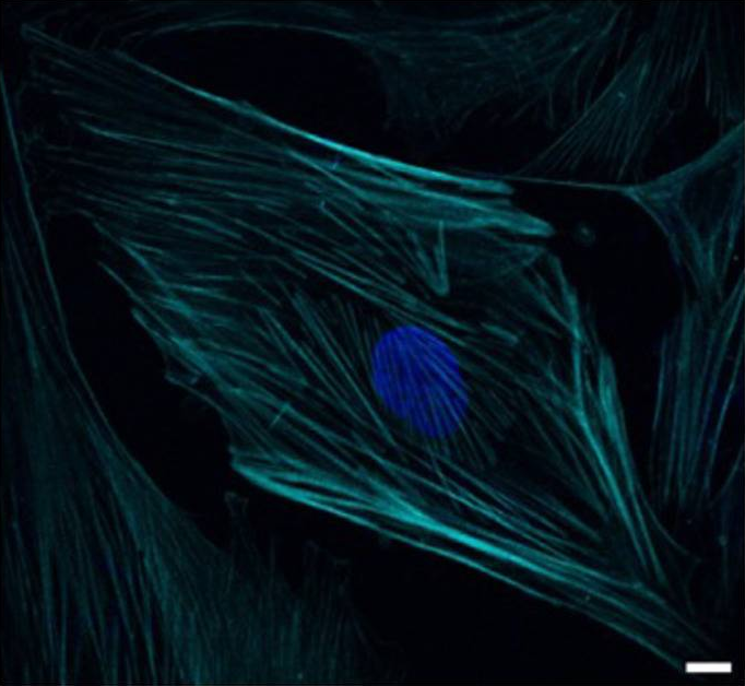 Published 8 cP fluorescence microscopy panel showing cyan actin fibers and blue staining, with the original scale bar